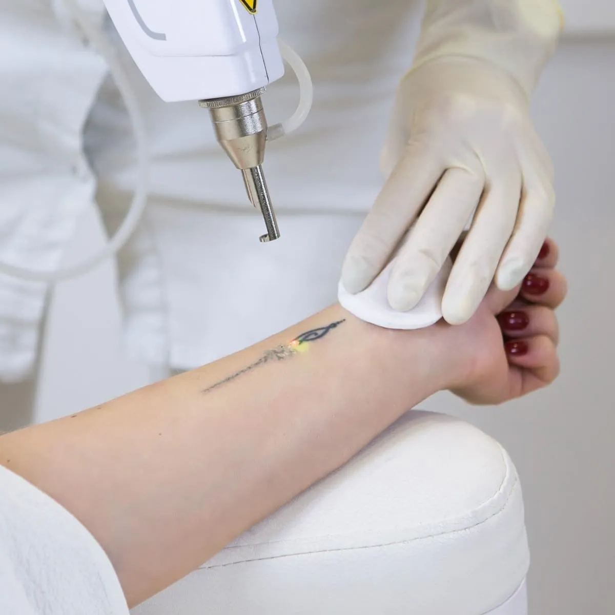 Tattoo & Scar Revision